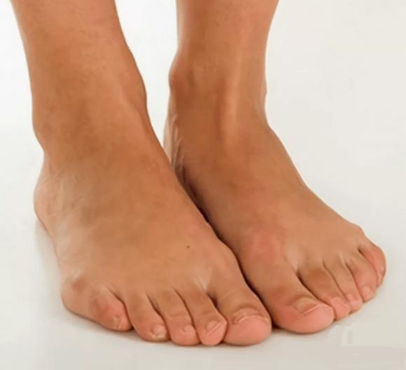 Здрави крака след третиране със спрей Hondrox