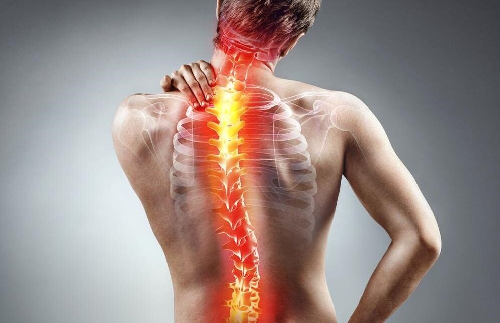 боли гърба с остеохондроза