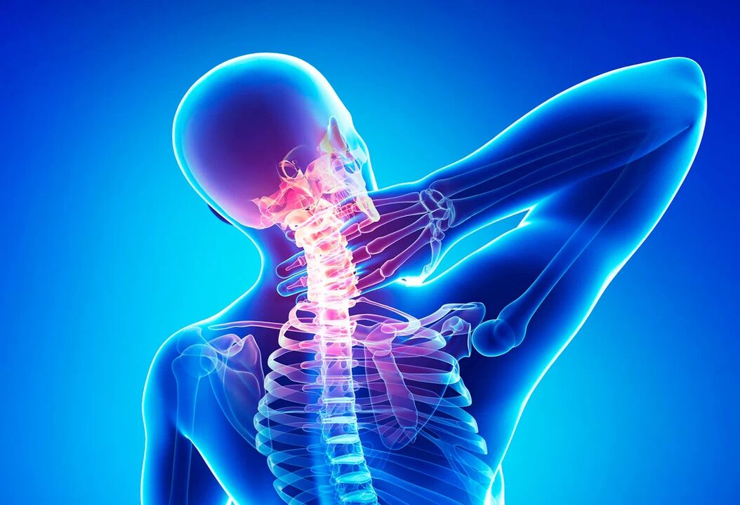 Остеохондрозата на гръбначния стълб е често срещано заболяване, което изисква лечение. 