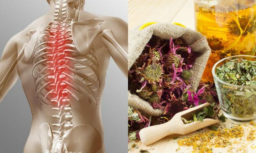 Традиционни рецепти - предотвратяват развитието на остеохондроза и поддържат здравето на гръбначния стълб